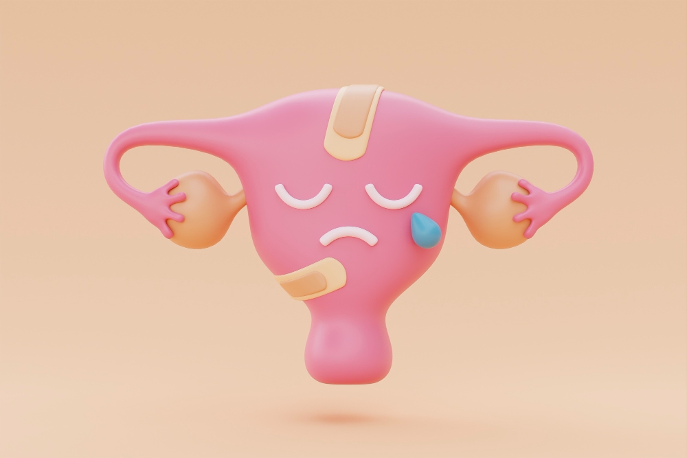  تنبلی تخمدان، علل و درمان