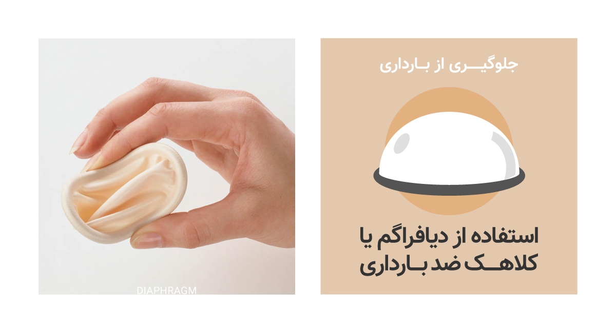 جلوگیری از بارداری با استفاده از دیافراگم یا کلاهک ضد بارداری 