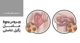 ویروس hpv عامل زگیل تناسلی