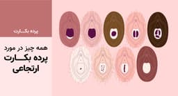 همه چیز در مورد پرده بکارت ارتجاعی 